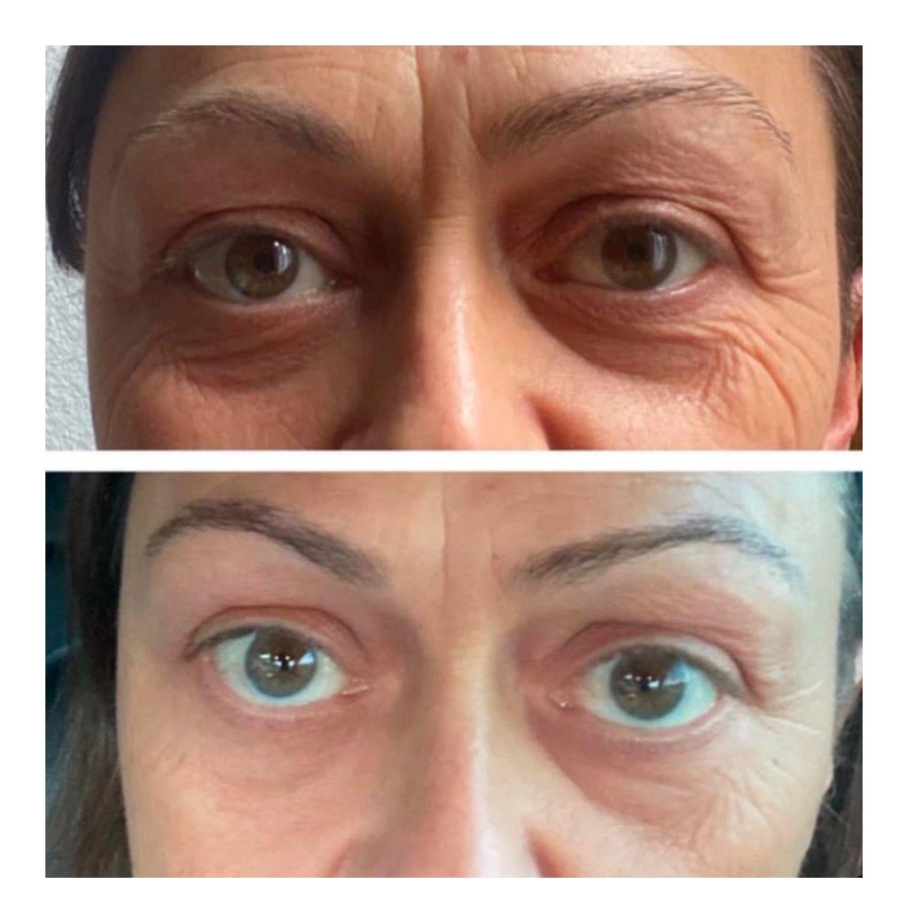 Essential Double Cleanse RIMAN Ritual - Snow Enzyme - We Are KBeauty - Korean Skincare Routine for Glass Skin