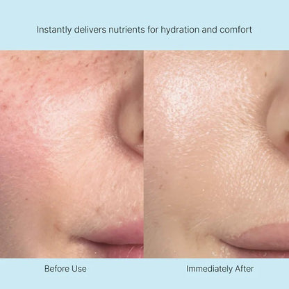 REJURAN Nutritive Cream 0.2% PDRN 2000ppm - Medical Grade - RIMAN KBeauty - 