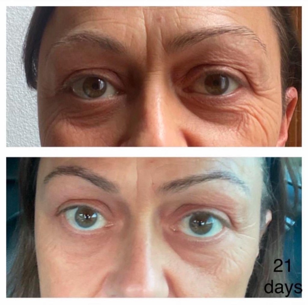 Incellderm Dermatology First Package Booster and Serum – RIMAN KBeauty