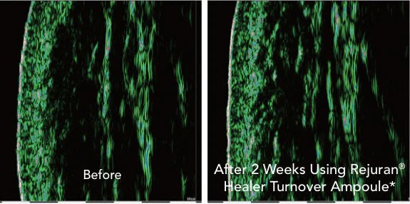 REJURAN Turnover Ampoule 0.5% cPDRN - RIMAN KBeauty - Korean Skincare Routine for Glass Skin