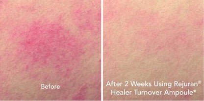 REJURAN Turnover Ampoule 0.5% cPDRN - RIMAN KBeauty - Korean Skincare Routine for Glass Skin