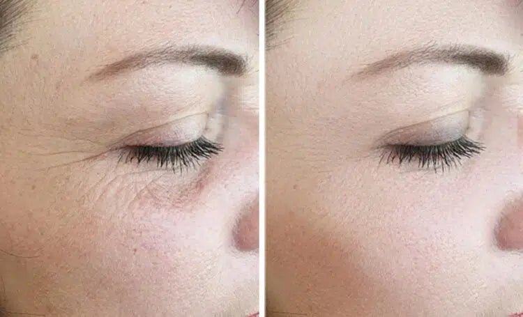 REJURAN Turnover Mask PDRN 1box 5ct. - RIMAN KBeauty - Korean Skincare Routine for Glass Skin