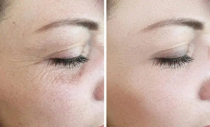 REJURAN Turnover Mask PDRN 1box 5ct. - RIMAN KBeauty - Korean Skincare Routine for Glass Skin