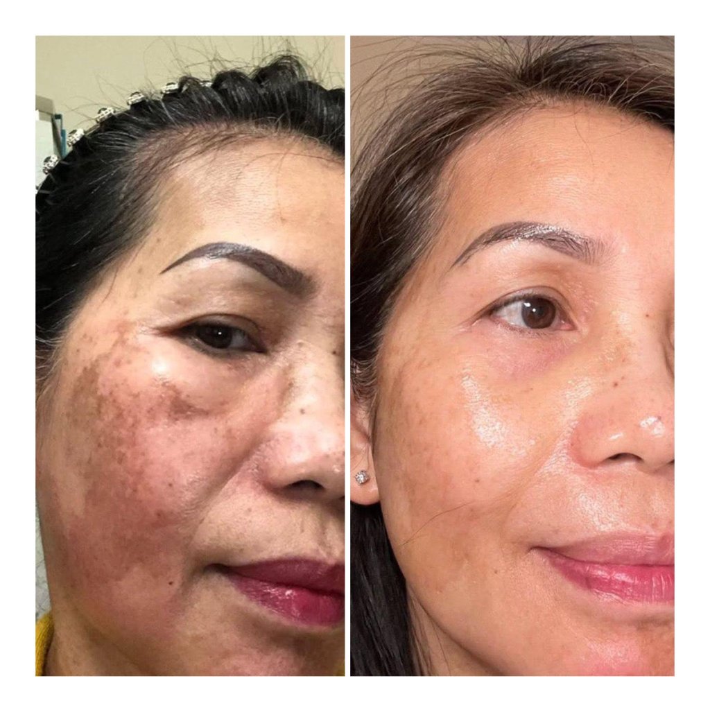 Essential Double Cleanse RIMAN Ritual - Snow Enzyme - We Are KBeauty - Korean Skincare Routine for Glass Skin