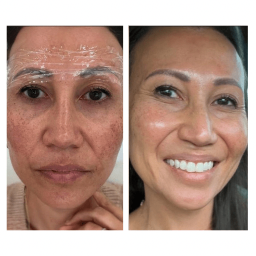 Essential Double Cleanse RIMAN Ritual - Snow Enzyme - We Are KBeauty - Korean Skincare Routine for Glass Skin