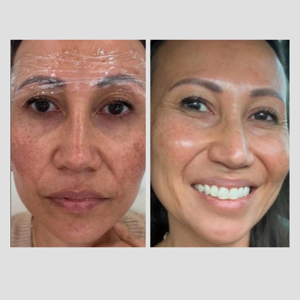 Essential RIMAN Ritual Kit - Incellderm ICD - We Are KBeauty - Korean Skincare Routine for Glass Skin