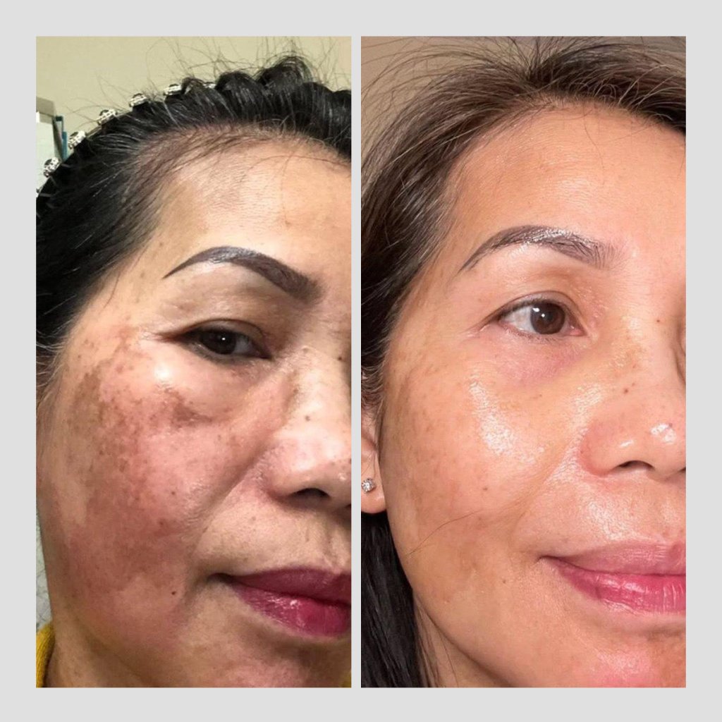 Essential RIMAN Ritual Kit - Incellderm ICD - We Are KBeauty - Korean Skincare Routine for Glass Skin