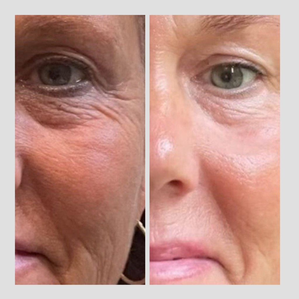 Essential RIMAN Ritual Kit - Incellderm ICD - We Are KBeauty - Korean Skincare Routine for Glass Skin