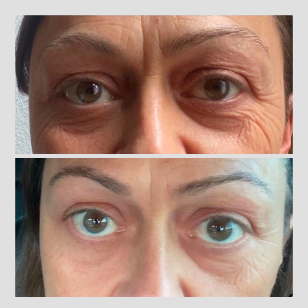 Essential RIMAN Ritual Kit - Incellderm ICD - We Are KBeauty - Korean Skincare Routine for Glass Skin